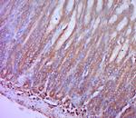 CCR2 Antibody in Immunohistochemistry (Paraffin) (IHC (P))