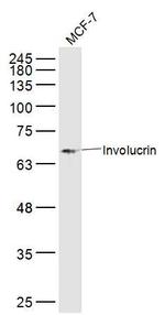 Involucrin Antibody in Western Blot (WB)