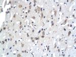 PKC epsilon Antibody in Immunohistochemistry (Paraffin) (IHC (P))