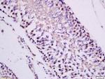 PKC epsilon Antibody in Immunohistochemistry (Paraffin) (IHC (P))