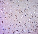 DGAT1/Diglyceride acyltransferase Antibody in Immunohistochemistry (Paraffin) (IHC (P))