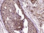 Progesterone Receptor Antibody in Immunohistochemistry (Paraffin) (IHC (P))