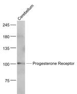 Progesterone Receptor Antibody in Western Blot (WB)