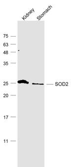 SOD2 Antibody in Western Blot (WB)