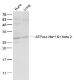 ATPase Na+/K+ beta 2 Antibody in Western Blot (WB)