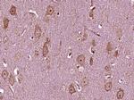 Asparagine synthetase Antibody in Immunohistochemistry (Paraffin) (IHC (P))