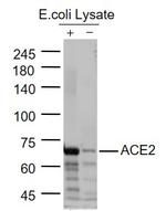 ACE2 Antibody in Western Blot (WB)