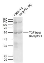 TGF beta Receptor I Antibody in Western Blot (WB)