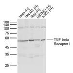 TGF beta Receptor I Antibody in Western Blot (WB)