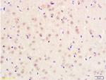 PITX3 Antibody in Immunohistochemistry (Paraffin) (IHC (P))