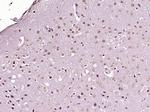 PITX3 Antibody in Immunohistochemistry (Paraffin) (IHC (P))