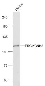 ERG/KCNH2 Antibody in Western Blot (WB)