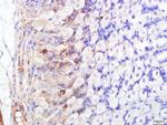 FABP5 Antibody in Immunohistochemistry (Paraffin) (IHC (P))