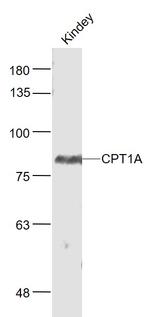 CPT1A Antibody in Western Blot (WB)