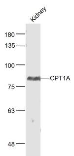 CPT1A Antibody in Western Blot (WB)