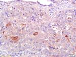 CNR2/CB2 Antibody in Immunohistochemistry (Paraffin) (IHC (P))