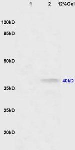 CNR2/CB2 Antibody in Western Blot (WB)