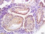 Signal recognition particle Antibody in Immunohistochemistry (Paraffin) (IHC (P))