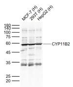 CYP11B2 Antibody in Western Blot (WB)
