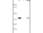 Coxsackie Adenovirus Receptor Antibody in Western Blot (WB)