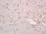 alpha Internexin Antibody in Immunohistochemistry (Paraffin) (IHC (P))