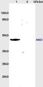 ABP/SHBG Antibody in Western Blot (WB)