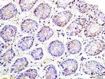 NKG2A Antibody in Immunohistochemistry (Paraffin) (IHC (P))