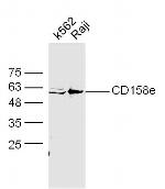 CD158e Antibody in Western Blot (WB)