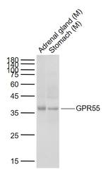 GPR55 Antibody in Western Blot (WB)