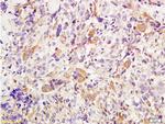 TWIST1 and TWIST2 Antibody in Immunohistochemistry (Paraffin) (IHC (P))