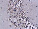 CCL17 Antibody in Immunohistochemistry (Paraffin) (IHC (P))