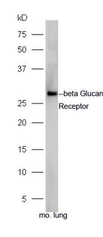 beta Glucan Receptor Antibody in Western Blot (WB)