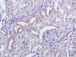 PERK Antibody in Immunohistochemistry (Paraffin) (IHC (P))