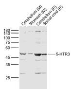 5-HTR3 Antibody in Western Blot (WB)