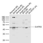 5-HTR3 Antibody in Western Blot (WB)