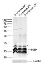 MBP Antibody in Western Blot (WB)