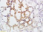 CD30 Antibody in Immunohistochemistry (Paraffin) (IHC (P))