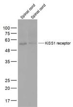 KiSS1 receptor Antibody in Western Blot (WB)