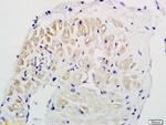 Cardiotrophin 1 Antibody in Immunohistochemistry (Paraffin) (IHC (P))