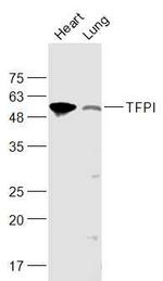 TFPI/LACI Antibody in Western Blot (WB)