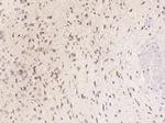 CXCL5 Antibody in Immunohistochemistry (Paraffin) (IHC (P))