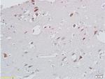 CXCL13/BCA1 Antibody in Immunohistochemistry (Paraffin) (IHC (P))