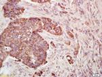 DEP1/PTPRJ Antibody in Immunohistochemistry (Paraffin) (IHC (P))