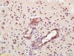 CD32 Antibody in Immunohistochemistry (Paraffin) (IHC (P))