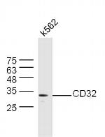 CD32 Antibody in Western Blot (WB)