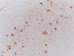 NRSF/REST Antibody in Immunohistochemistry (Paraffin) (IHC (P))