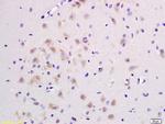 JNK1+2+3 Antibody in Immunohistochemistry (Paraffin) (IHC (P))