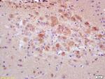 Caspase 3 Antibody in Immunohistochemistry (Paraffin) (IHC (P))