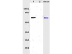 IL-1R1 Antibody in Western Blot (WB)