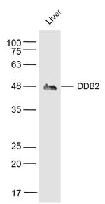 DDB2 Antibody in Western Blot (WB)